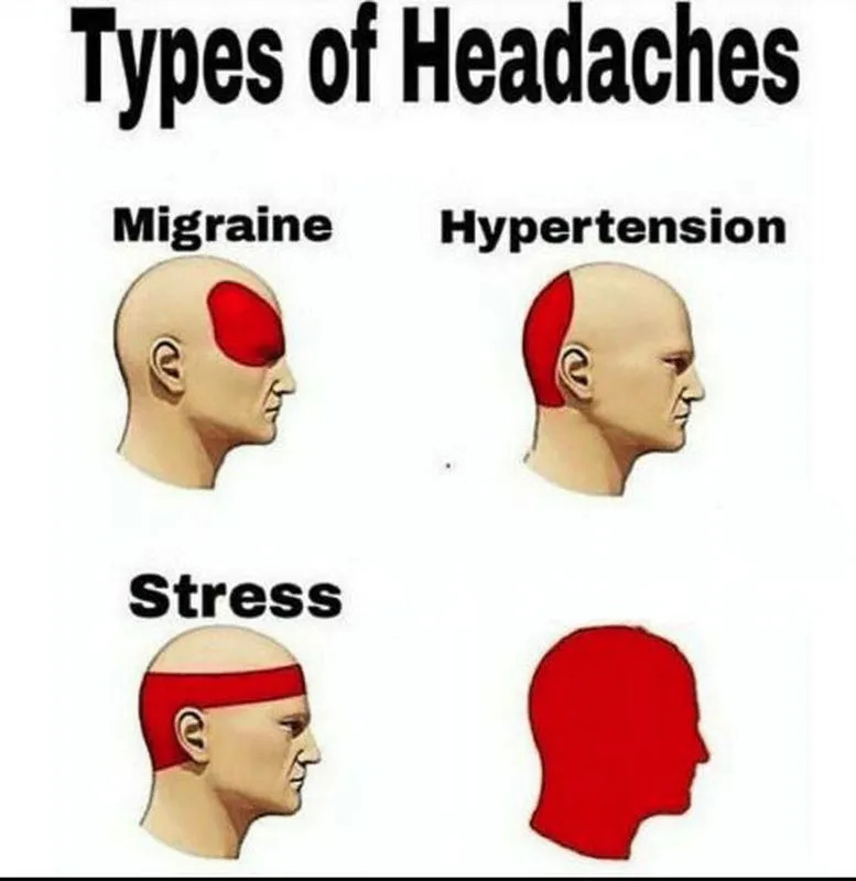 Meme template Types of Headaches meme